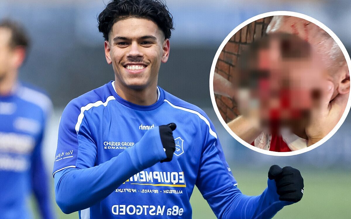 GVVV zet beide trainers op straat na klap waarbij speler zeven tanden verliest