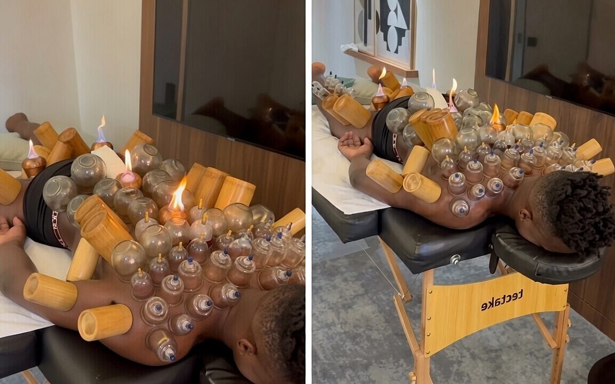 Oud-Ajax-keeper André Onana kiest voor extreme cuppingtherapie
