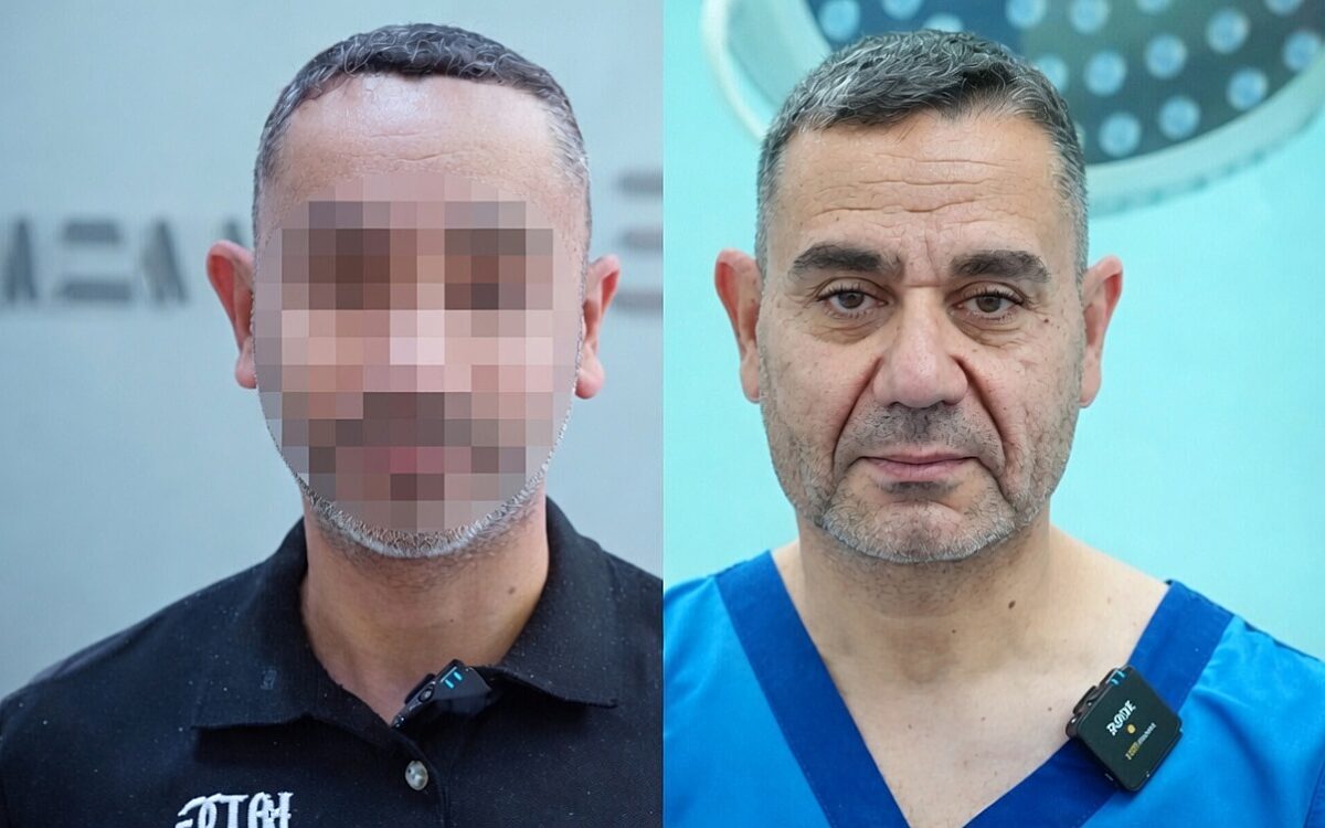Na operatie oogt 58-jarige Turk opeens 25 jaar jonger

Een 58-jarige man uit Turkije heeft zich onder handen laten nemen door een chirurg, en het resultaat is verrassend. Na de ingreep ziet hij er ineens 25 jaar jonger uit.
