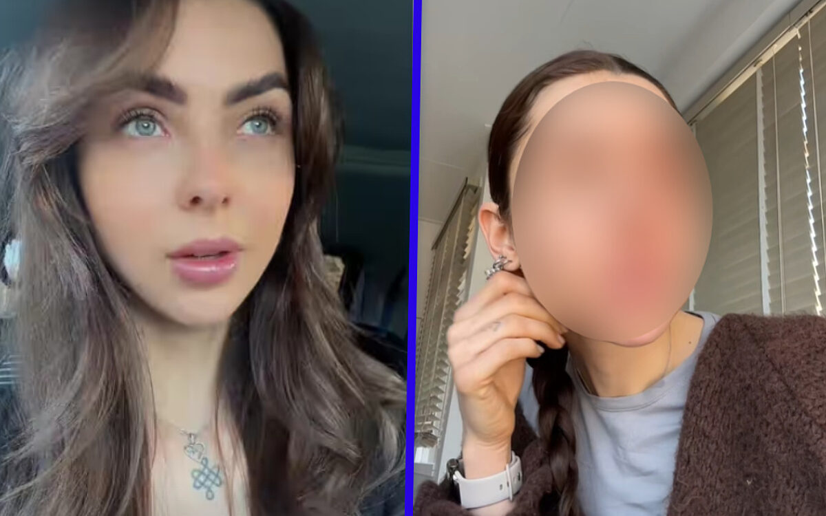 Influencer raakt gewond door ploffende blender, loopt brandwonden en oogletsel op: "Weet niet of dit herstelt"