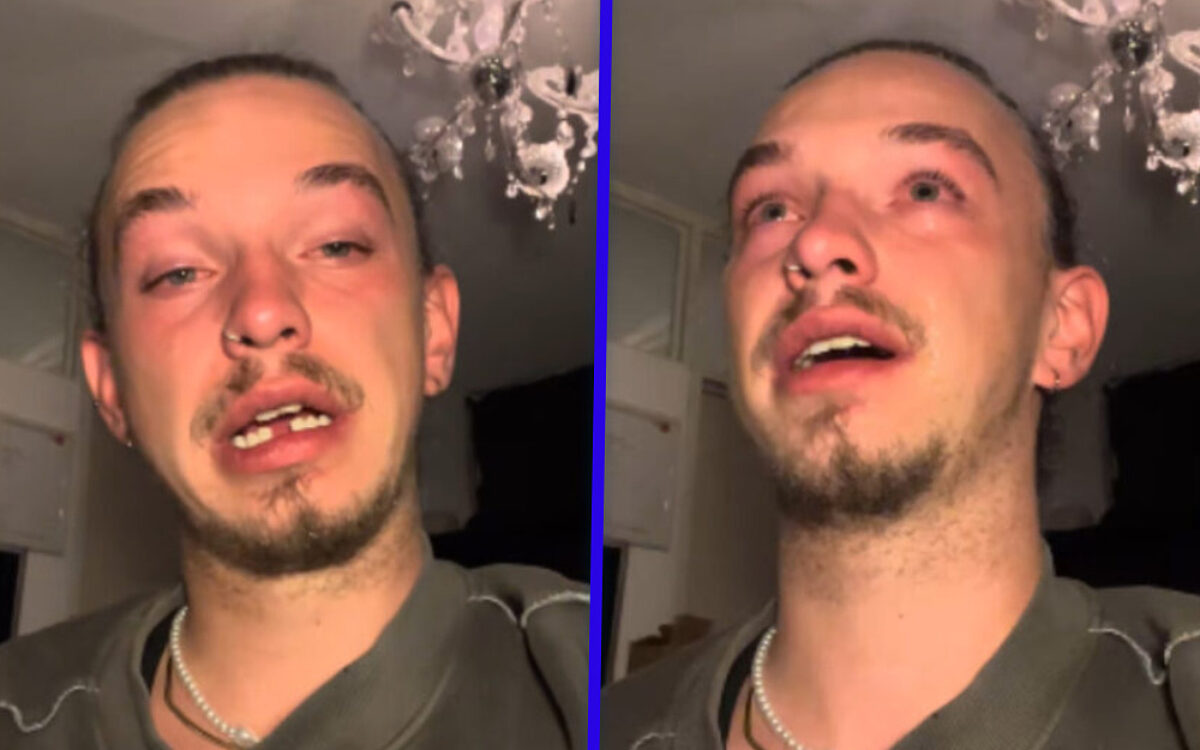 Verjaardag Trevor (30) eindigt in ziekenhuis na brute homofobe aanval