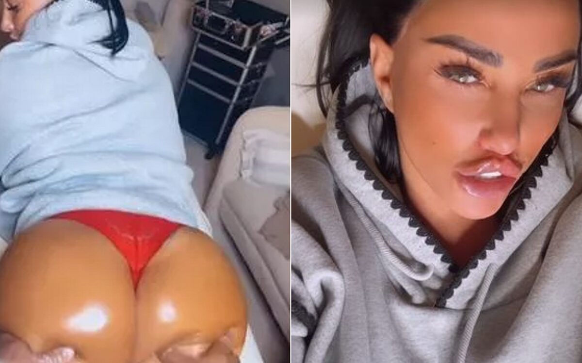 Zien: Model Katie Price laat lippen en billen opspuiten