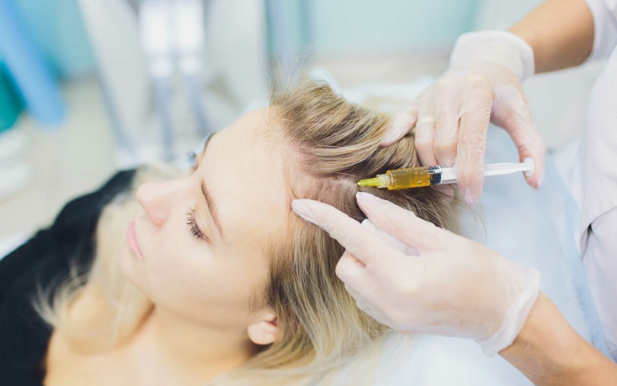 Waarom steeds meer mensen kiezen voor een haartransplantatie
